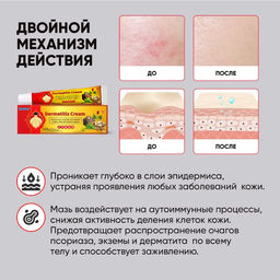 Мазь-крем от высыпаний на спине, псориаза, экземы, атопического дерматита,акне 20гр - Aopen фото 2