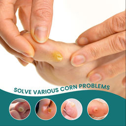 Пластырь для удаления стержневых мазолей на ногах 24 шт