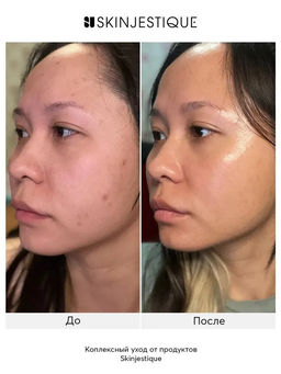 Пептидный гель для умывания с олигопептидом VEZE, 60 г FZ56394  фото 6