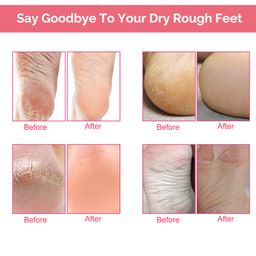 Отшелушивающая маска-носки для педикюра с экстрактом персика - Elaimei фото 7