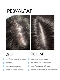 System 4 Терапевтический шампунь №3, 500 мл - Sim sensitive фото 3