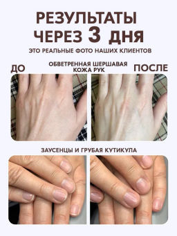 Крем для тела от сухости и трещин Bonimed, 125 мл Boni-0101