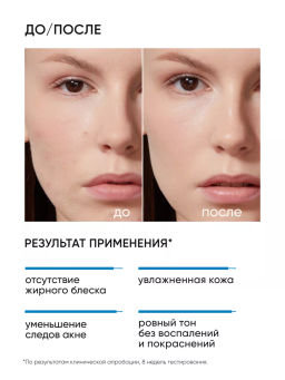 Увлажняющий крем для лица склонной к акне - Icon skin фото 3