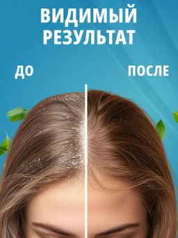 Nexxt Prophylactic Шампунь лечебный от перхоти, 1000 мл фото 4