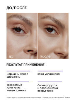 Крем вокруг глаз антивозрастной омолаживающий с ретинолом - Icon skin фото 4