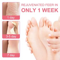 Отшелушивающая маска-носки для педикюра с экстрактом персика - Elaimei фото 5