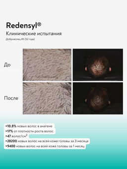 Careprost для ВОЛОС