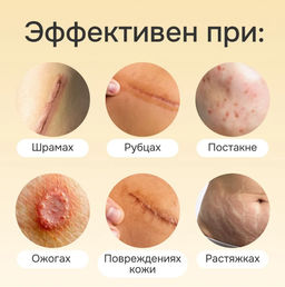 Крем от шрамов и рубцов, постакне, растяжек с маслом змеи 20гр - Aopen фото 2