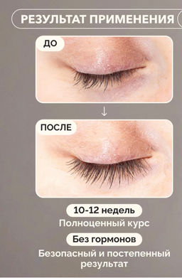 Сыворотка для роста ресниц и бровей 10 мл - Sadoer фото 3
