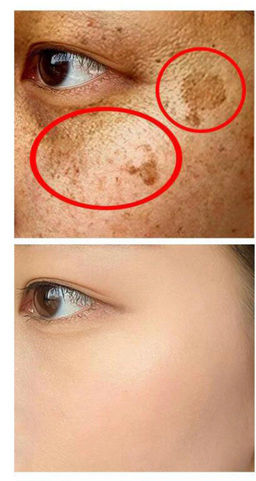 Крем для отбеливания и удаления пигментных пятен Fuyan, 20г - Houmai фото 3