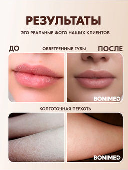 Крем от трещин, сухости и шелушений BONIMED REHABER, 100 гр  фото 8