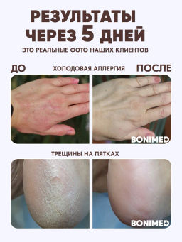 Крем профессиональный от сухости и трещин Bonimed 500 мл Boni-0108  фото 8