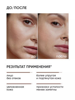 Тоник для лица от отеков лимфодренажный - Icon skin фото 3