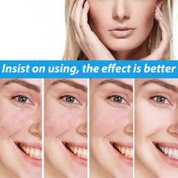 Осветляющая сыворотка от прыщей, 30 мл - Images фото 4