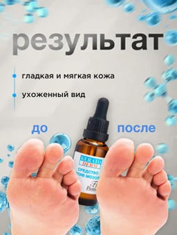 Ф-649 Средство против мозолей и натоптышей 50 мл/12 шт новинка