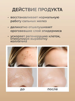 SADOER Отшелушивающий тонер с гликолевой кислотой Glycolic Acid 7% Toner, 230 мл  фото 3