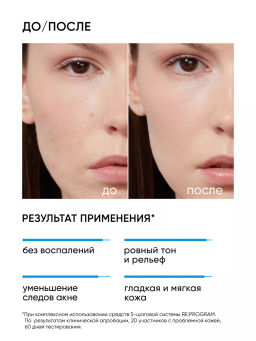 Пилинг для лица 11% от акне и воспалений - Icon skin фото 4