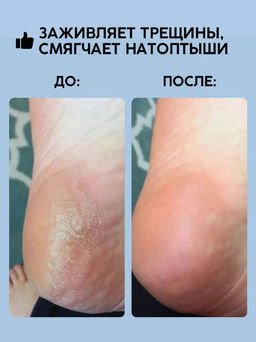 Набор для рук и ног питание и регенерация Волшебные воски + Нежные лапки 50 мл+ 50 мл