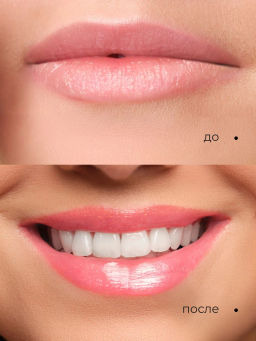 Блеск для губ Artdeco Hydra Lip Booster ухаживающий тон 46 6 мл  фото 5