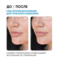 Точечное SOS-средство от воспалений, 20 мл ICON SKIN  фото 4