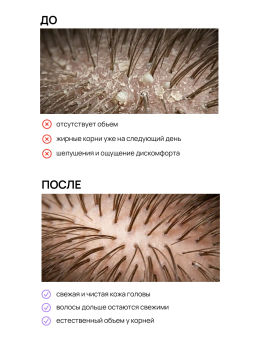 Маска кераторегулирующая для волос и кожи головы 500 мл Meela Meelo  фото 5