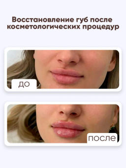 Бальзам для губ от трещин Bonimed, 2,6 г, Boni-0107