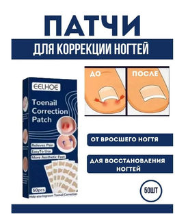 Пластыри наклеки для коррекции вросшего ногтя 50шт