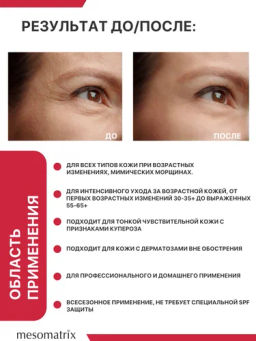 Крем от морщин с пептидами-миорелаксантами MYO RELAX PEPTIDE 30 мл - Mesomatrix фото 2