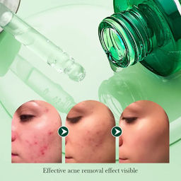 SADOER Успокаивающая сыворотка на основе чайного дерева для проблемной кожи 30мл  фото 2