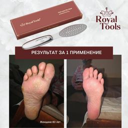 Терка для ног с силиконовой вставкой Royal Tools