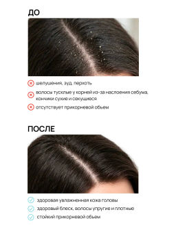 Маска для волос против перхоти 500 мл Meela Meelo  фото 5