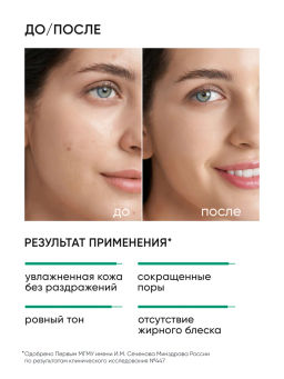 Крем для лица увлажняющий для жирной и комбинированной кожи - Icon skin фото 3