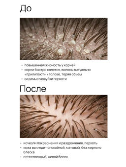 Шампунь кераторегулирующий для волос и кожи головы 400 мл Meela Meelo  фото 5