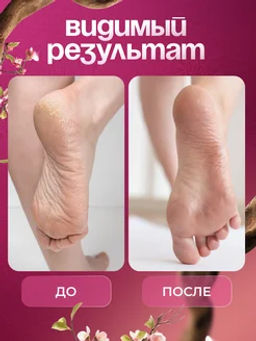 Карандаш-стик для рук и ног против трещин персик - Sadoer фото 4