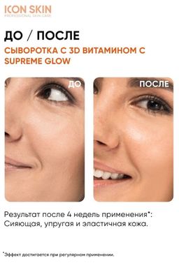 Омолаживающая сыворотка для лица с витамином С и пептидами, для улучшения цвета лица, 30 мл - Icon skin фото 8