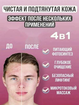 Ультразвуковой аппарат для чистка лица,белый