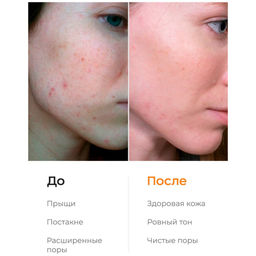 Likato Энзимная пудра для очищения чувствительной кожи и осветления следов постакне, 150 мл  фото 6