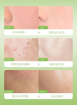 Глина косметическая Осветление Для проблемной кожи - Sadoer фото 3