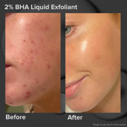 PAULA'S CHOICE Тоник эксфолиант SKIN PERFECTING 2% BHA LIQUID EXFOLIANT 118ml