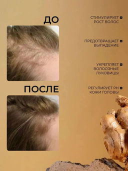 SADOER Сыворотка для волос, 30 мл