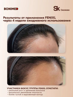 Сыворотка от выпадения и для роста волос FENIXL Boni-0131 - Bonimed фото 2