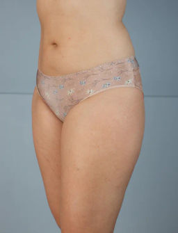 Трусы Т 0266-125 Поцелуй