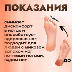 Крем для ног антибактериальный 20гр - Aopen фото 2