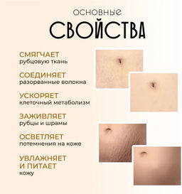 Заживляющий крем от шрамов , рубцов, ожогов, постакне.20гр - Aopen фото 3