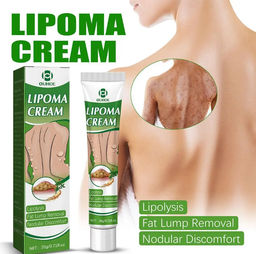 Крем Lipoma для удаления опухолей, средство для удаления отеков кожи, нодулярного дискомфорта, лечения липолиза, крем для удаления жира - Buro фото 2