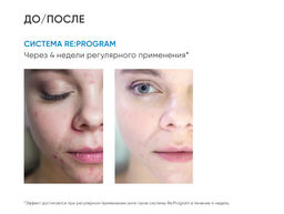 Набор для ухода за кожей лица Re Program, trial size, 4 средства - Icon skin фото 4