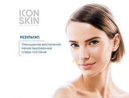 Пилинг для лица с 18% комплексом кислот. Лечение тяжелой степени акне. Для проблемной и комбинирован - Icon skin фото 9
