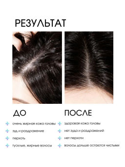 System 4 Терапевтический шампунь №4, 250 мл - Sim sensitive фото 3