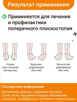 Выкладка поперечного свода Talus 61к