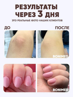 Крем от сухости и трещин на руках Bonimed, 125 мл Boni-0103